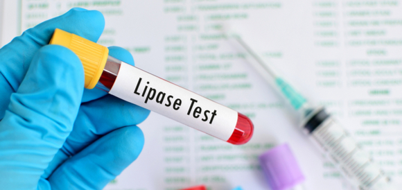 בדיקת עופרת (Lead) - תמונה